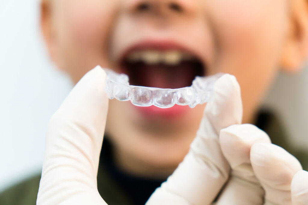 Orthodontist inserting an invisalign aligner for a young patient receiving Invisalign First