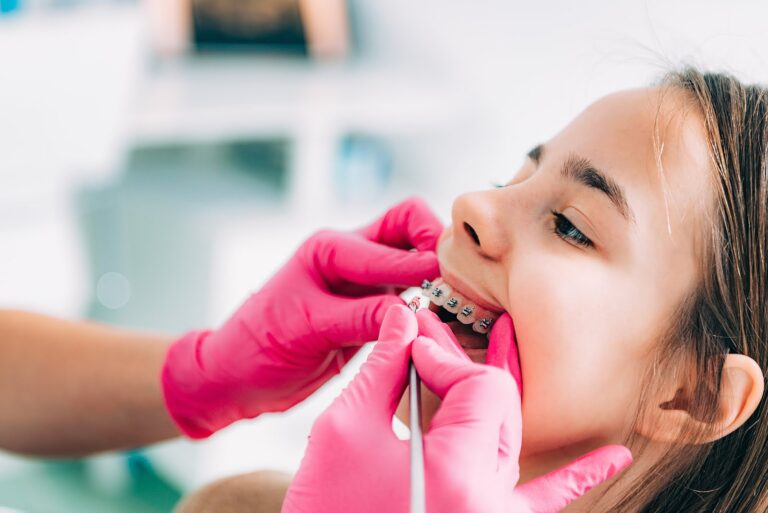 Braces Pain Relief: How to Ease Soreness After Adjustments
