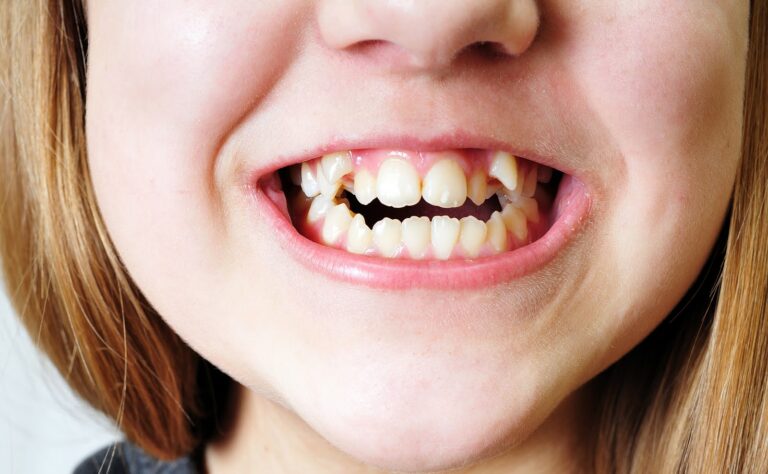 Signs You Need Orthodontics: How to Know When It’s Time