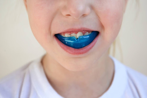 Mouth guard for braces to avoid injury