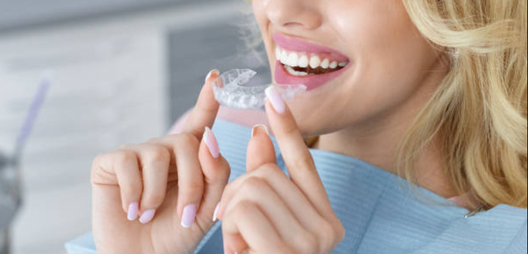Best City for Affordable Orthodontics: Baltimore vs New York City 