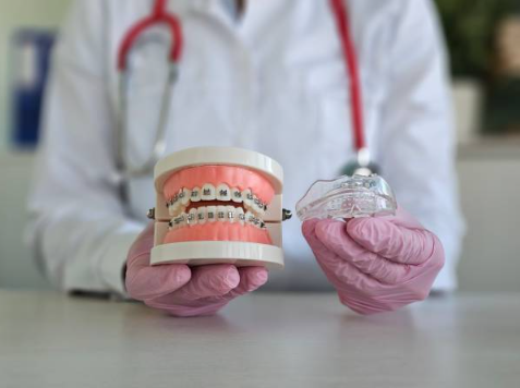 expense of Invisalign